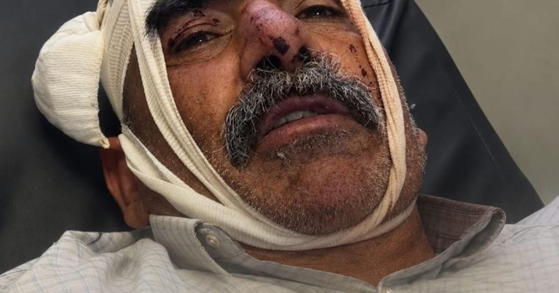 مأمون نصار من مادما يروي ساعات الاعتداء: «رشّوا الفلفل في فمي».