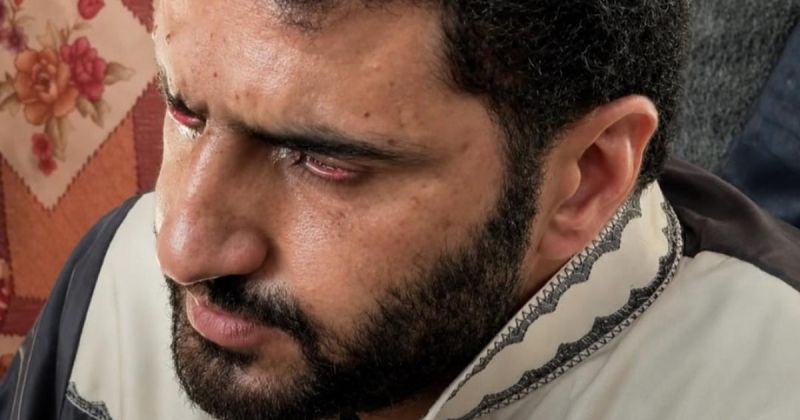 خرج حرًا .. محمود أبو فول يفقد بصره تحت التعذيب بعد أن فقد ساقه في الحرب