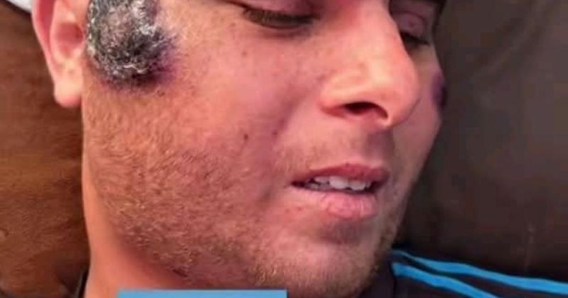 وسيم أبو يوسف.. مريض سرطان في غزة ينتظر بوابة العلاج قبل أن يسبقه الموت