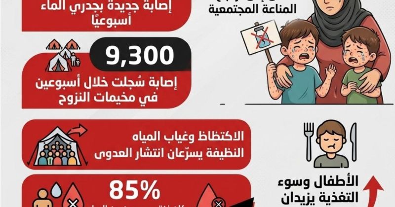 انفوجرافيك: جدري الماء يتفشى في غزة.. والأطفال الأكثر تضررًا
