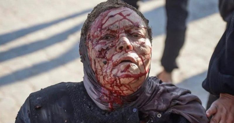 خرجت تبحث عن قليل من الهواء.. ليلى مرتجى تفقد يدها وابنها في قصف ميناء غزة