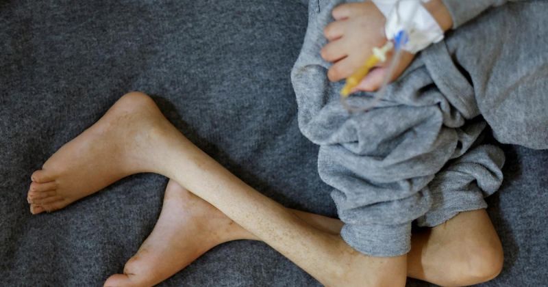 وزارة الصحة تحذر: معدلات سوء التغذية بلغت مستويات كارثية