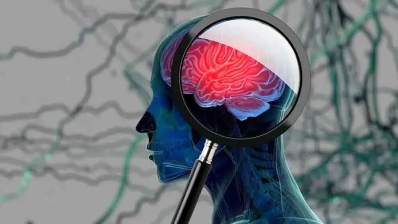 دراسة حديثة: التعليم الإضافي في سن المراهقة يقلل من احتمالات الإصابة بالخرف