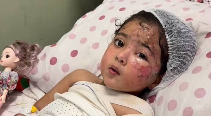مريم طفلة غزة.. حكاية نجاة من وسط النيران وفقدان للأم تحت القصف