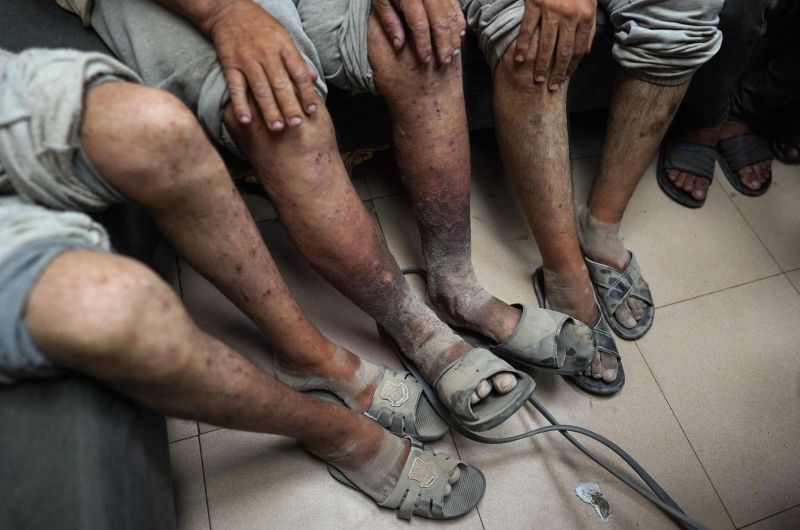 14 أسيرًا من غزة يتنسمون الحرية بأوضاع صحية صعبة