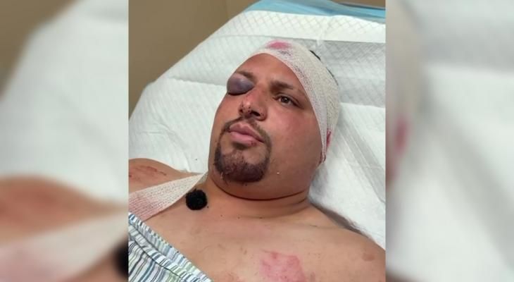 أطلقوا النار ثم هاجمونا بالفؤوس.. شهادة حول جرائم المستوطنين في دير أبو مشعل