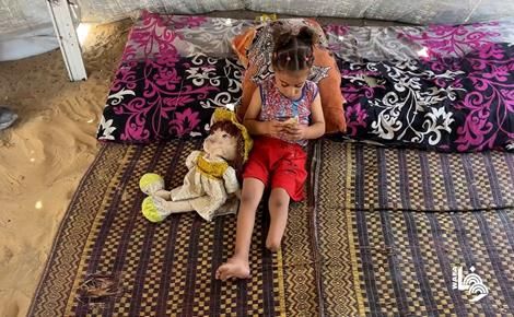 طفلة غزة جمالات.. سرقت الإبادة ساقها وتركتها تحلم بالركض
