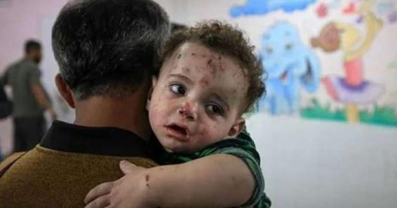 5000 إصابة أسبوعيًا: تحذيرات من اتساع رقعة "جدري الماء" في قطاع غزة