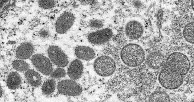 إيبولا بونديبوغيو يتمدد من شرق الكونغو إلى أوغندا… قلق دولي من سرعة التفشي والأردن يمنع القادمين من البلدين احترازياً