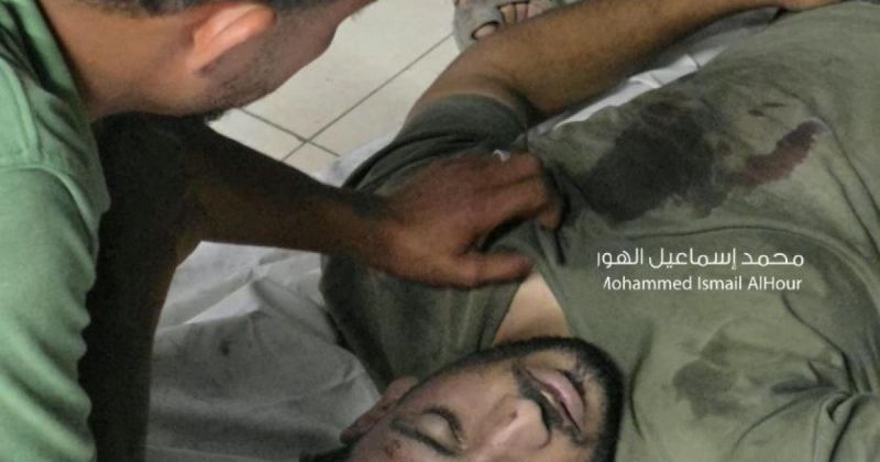 شهيد وإصابات في إطلاق نار وقصف إسرائيليين بمدينة غزة ووسط القطاع