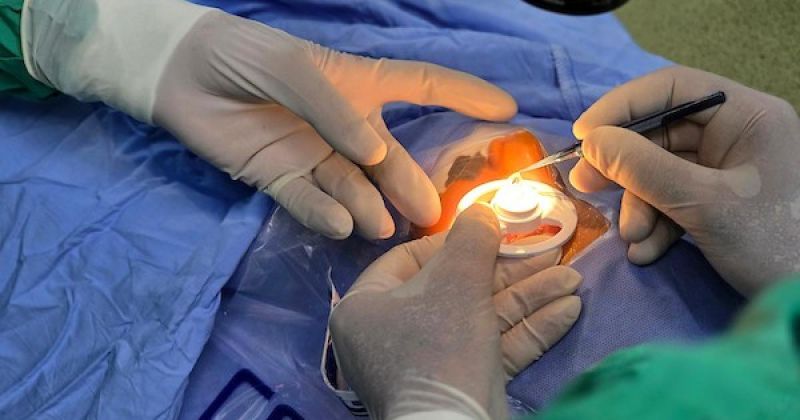 عملية زرع قرنية لفتاة تبلغ من العمر 12 عامًا في مجمع ناصر الطبي