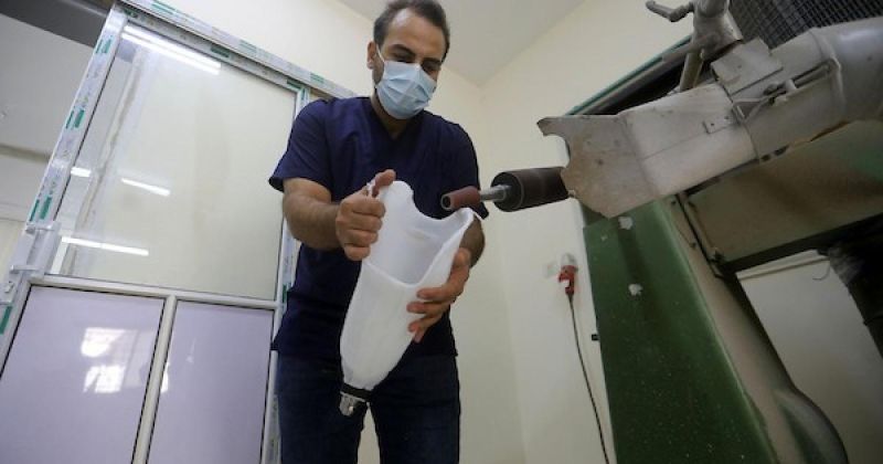 غزة.. صناعة الأطراف الاصطناعية تتحدى نقص المستلزمات الطبية