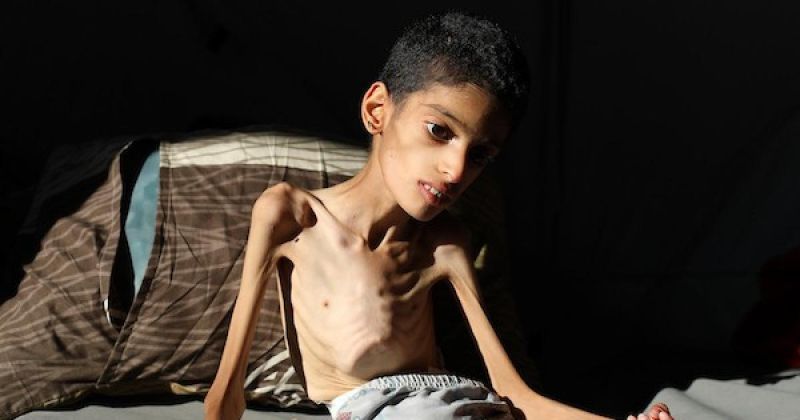 «أنقذوا إبراهيم»..طفل من غزة يزن 7.5 كيلوغرامات ووالدته تناشد إجلاءه للعلاج