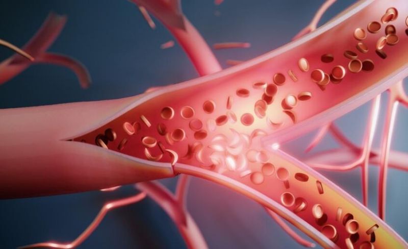 علاقة مثيرة للجدل بين مستويات B12 والسرطان