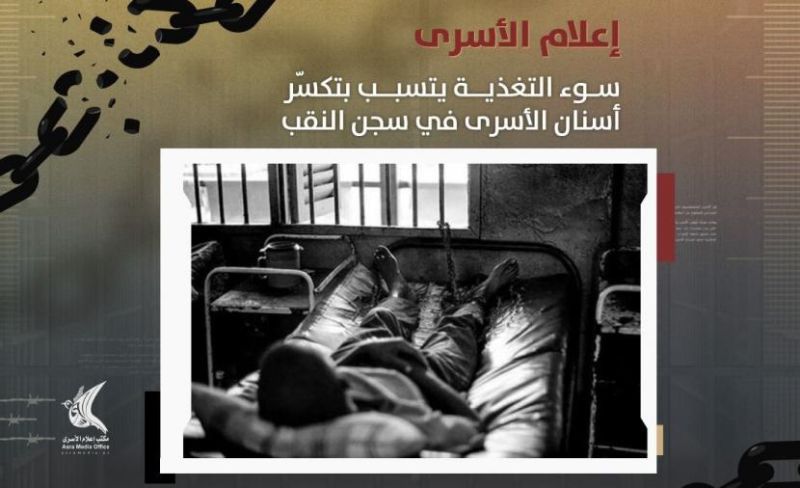 "إعلام الأسرى": سياسة التجويع وسوء التغذية تتسببان بتكسّر أسنان الأسرى في سجن النقب