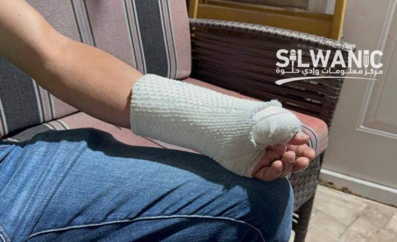 مقدسي يروي تفاصيل اعتداء مستوطنين عليه خلال عمله بالقدس