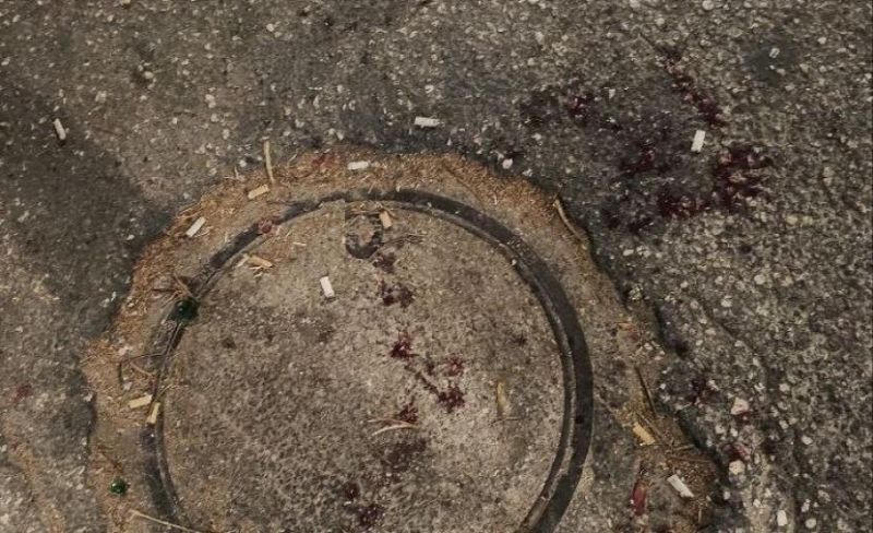 إصابة مواطن بالرصاص الحي خلال اقتحام الاحتلال لقلقيلية