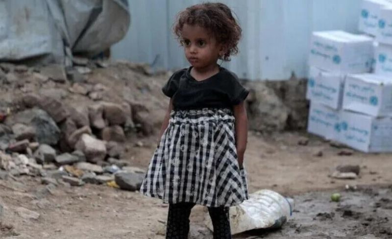 الأمم المتحدة: الجوع والنزوح يفاقمان معاناة أطفال اليمن