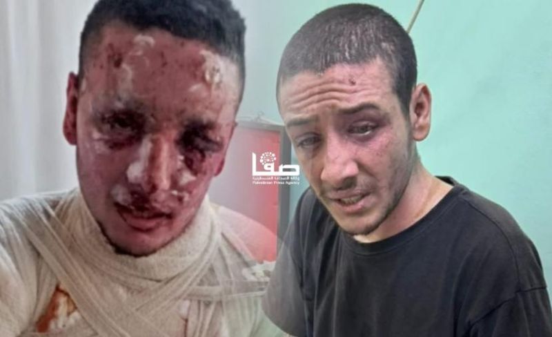 شظية تتغذى على عينيه.. يحيى يطرق باب العشرينيات ببصر يحتضر