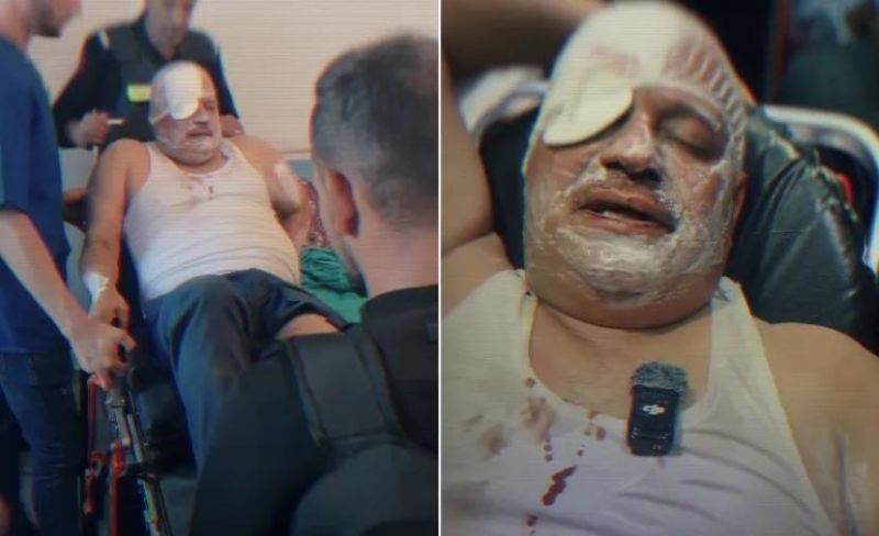 "سرقوا جوازي".. مواطن أمريكي يكشف تفاصيل اعتداء وحشي للمستوطنين عليه برام الله