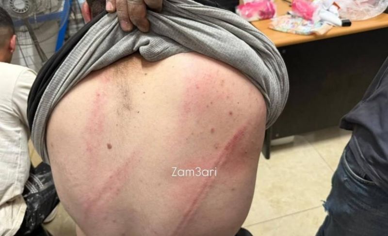 إصابتان باعتداء مستوطنين على قاطفي الزيتون غرب رام الله