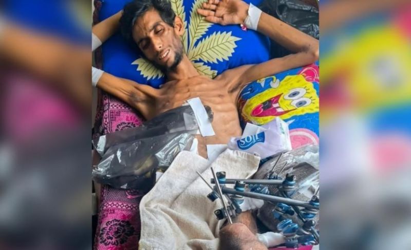 منذ "قذيفة" حي التفاح.. حديد ينهش جسد "محمد" وروحه معلقة بالمعبر