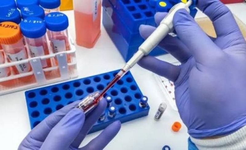 الصحة بغزة تحذر من انهيار الخدمة المخبرية وتطالب بتدخل عاجل