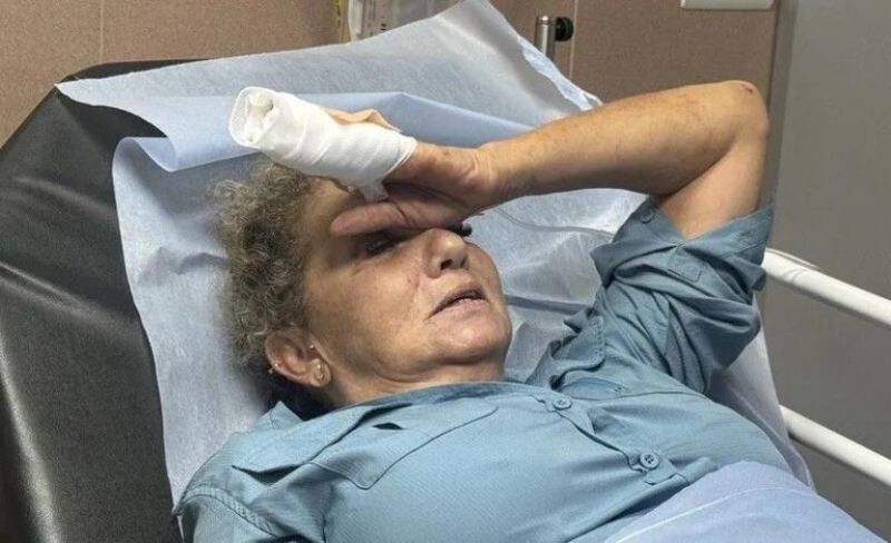 مصورة "واشنطن بوست" تروي إرهاب المستوطنين: ركلوني أكثر من 10 دقائق