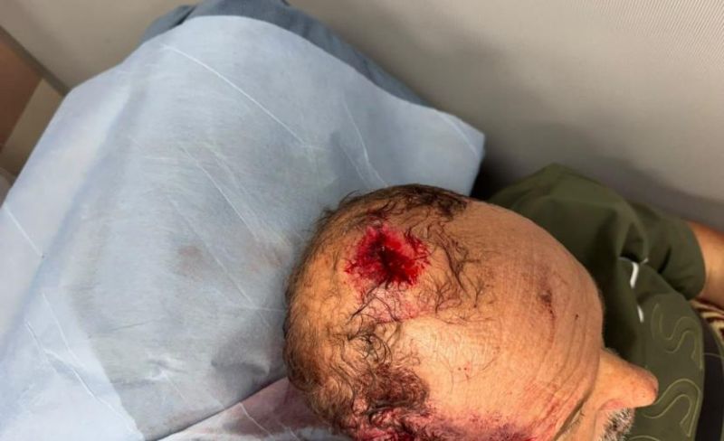 إصابة مزارع فلسطيني شرق رام الله