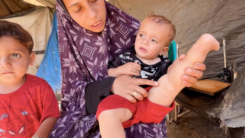 جيل الـ1000 يوم في غزة.. خيمة وعضة جرذ ومآس أخرى